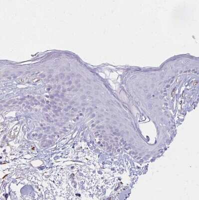 Immunohistochemistry-Paraffin: TTYH1 Antibody [NBP2-38634]