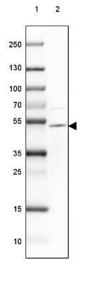 Western Blot: TTYH1 Antibody [NBP2-38634]