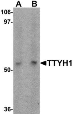 Western Blot: TTYH1 AntibodyBSA Free [NBP2-81944]