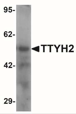 Western Blot: TTYH2 AntibodyBSA Free [NBP2-41177]