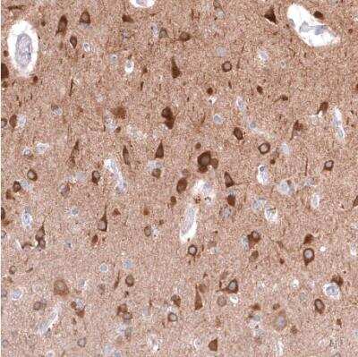 Immunohistochemistry-Paraffin: TTYH3 Antibody [NBP2-30621]