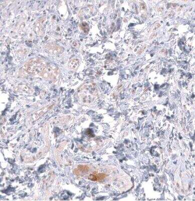 Immunohistochemistry-Paraffin: TTYH3 Antibody [NBP2-30621]