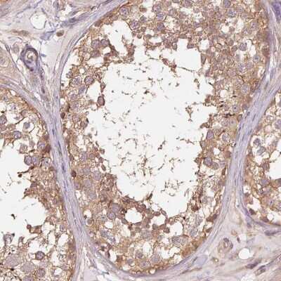 Immunohistochemistry-Paraffin: Tubulin alpha-1B Antibody [NBP2-46870]