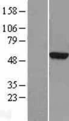 Western Blot: TUBA3D Overexpression Lysate [NBL1-17431]