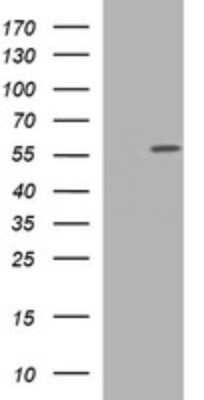 Western Blot: TUBA6 Antibody (OTI1D8) [NBP2-46244]