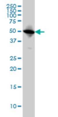 Western Blot: TUBA6 Antibody (S11) [H00084790-M04]