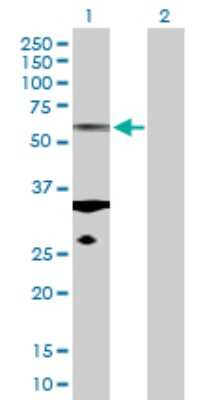 Western Blot: TUBA6 Antibody [H00084790-D01P]