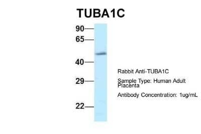 Western Blot: TUBA6 Antibody [NBP1-79849]