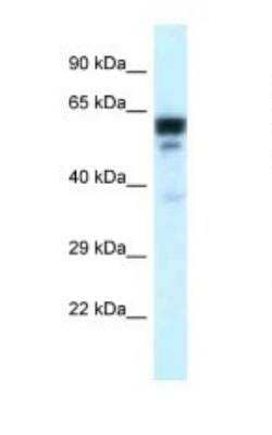 Western Blot: TUBA6 Antibody [NBP1-79850]