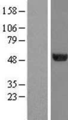 Western Blot: TUBA6 Overexpression Lysate [NBL1-17429]