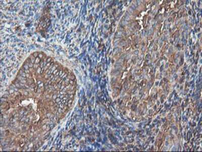 Immunohistochemistry-Paraffin: TUBAL3 Antibody (OTI4C5) [NBP2-01476]