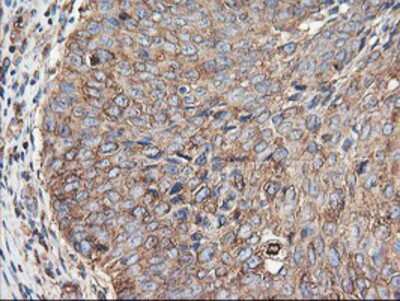 Immunohistochemistry-Paraffin: TUBAL3 Antibody (OTI4C5) [NBP2-01476]