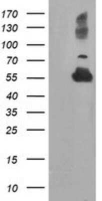 Western Blot: TUBAL3 Antibody (OTI4C5) [NBP2-01476]