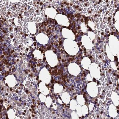 Immunohistochemistry-Paraffin: TUBAL3 Antibody [NBP1-92545]