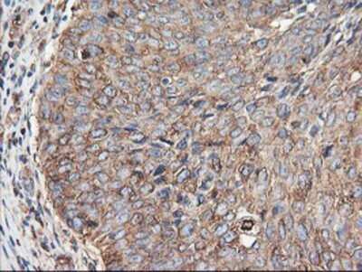 Immunohistochemistry: TUBAL3 Antibody (OTI4C5) - Azide and BSA Free [NBP2-74696]