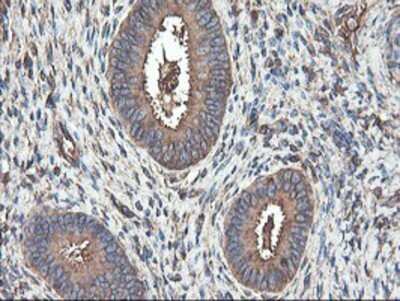 Immunohistochemistry: TUBAL3 Antibody (OTI4C5) - Azide and BSA Free [NBP2-74696]