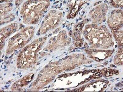 Immunohistochemistry: TUBAL3 Antibody (OTI4C5) - Azide and BSA Free [NBP2-74696]