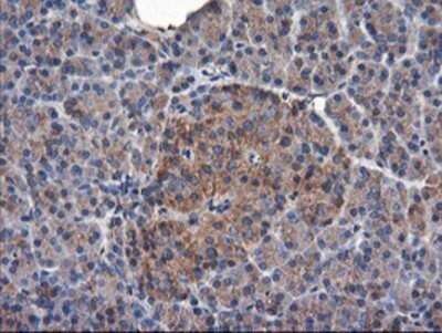 Immunohistochemistry: TUBAL3 Antibody (OTI4C5) - Azide and BSA Free [NBP2-74696]