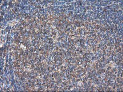 Immunohistochemistry: TUBAL3 Antibody (OTI4C5) - Azide and BSA Free [NBP2-74696]