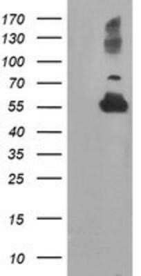 Western Blot: TUBAL3 Antibody (OTI4C5)Azide and BSA Free [NBP2-74696]