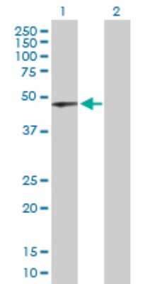 Western Blot: TUBAL3 Antibody [H00079861-D01P]