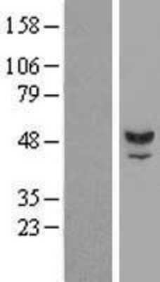 Western Blot: TUBAL3 Overexpression Lysate [NBP2-06285]