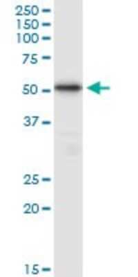 Western Blot: TUBB4Q Antibody [H00056604-B01P]