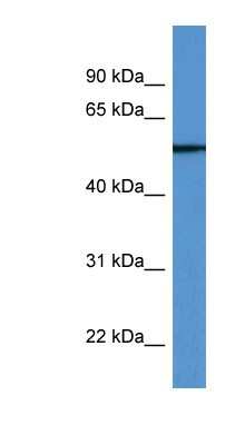 Western Blot: TUBB6 Antibody [NBP1-79815]