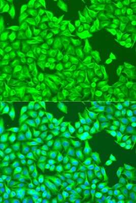 Immunocytochemistry/ Immunofluorescence: TUBB8 Antibody - BSA Free [NBP3-05594]