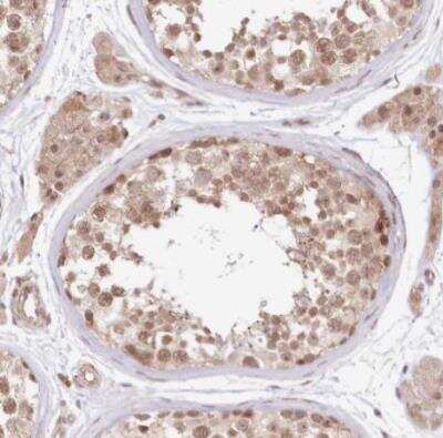 Immunohistochemistry-Paraffin: TUBGCP2 Antibody [NBP1-81841]