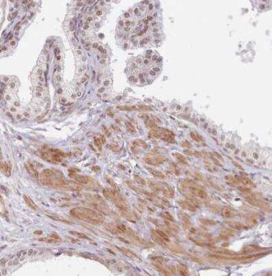 Immunohistochemistry-Paraffin: TUBGCP2 Antibody [NBP1-81841]