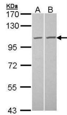 Western Blot: TUBGCP2 Antibody [NBP2-53097]