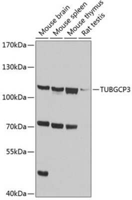 Western Blot: TUBGCP3 AntibodyBSA Free [NBP2-93107]