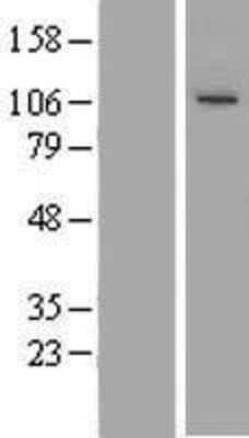 Western Blot: TUBGCP3 Overexpression Lysate [NBL1-17447]