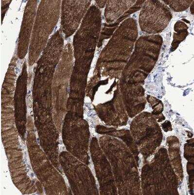 Immunohistochemistry-Paraffin: TUBGCP5 Antibody [NBP1-83380]