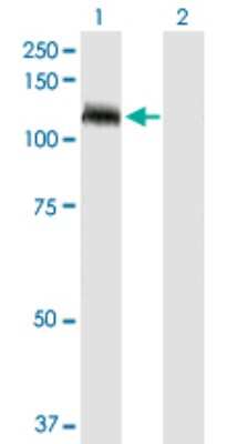 Western Blot: TUBGCP5 Antibody [H00114791-D01P]