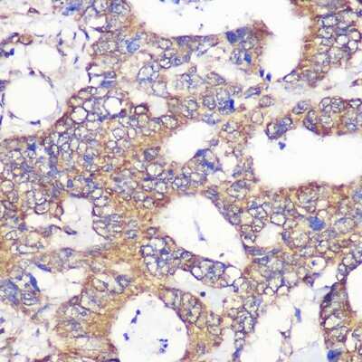 Immunohistochemistry-Paraffin: TUBGCP6 Antibody - Azide and BSA Free [NBP2-94428]