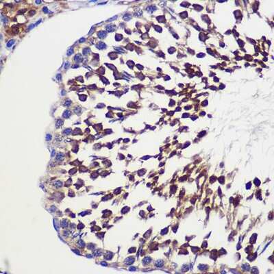 Immunohistochemistry-Paraffin: TUBGCP6 Antibody - Azide and BSA Free [NBP2-94428]