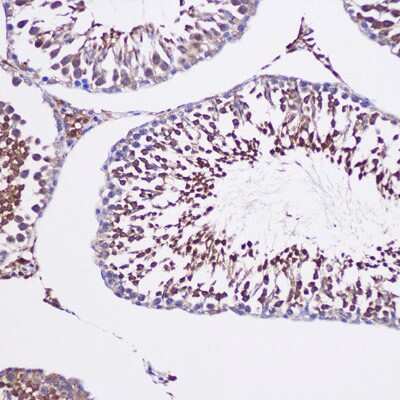 Immunohistochemistry-Paraffin: TUBGCP6 Antibody - Azide and BSA Free [NBP2-94428]