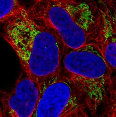 Immunocytochemistry/ Immunofluorescence: TUFM Antibody (CL2242) [NBP2-36751]