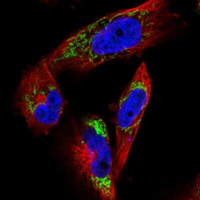 Immunocytochemistry/ Immunofluorescence: TUFM Antibody (CL2242) [NBP2-36751]