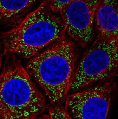 Immunocytochemistry/ Immunofluorescence: TUFM Antibody (CL2242) [NBP2-36751]