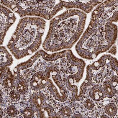 Immunohistochemistry-Paraffin: TUFM Antibody (CL2242) [NBP2-36751]