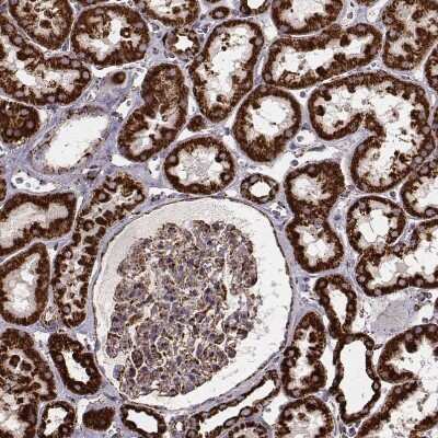 Immunohistochemistry-Paraffin: TUFM Antibody (CL2242) [NBP2-36751]