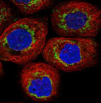 Immunocytochemistry/ Immunofluorescence: TUFM Antibody (CL2243) [NBP2-36752]