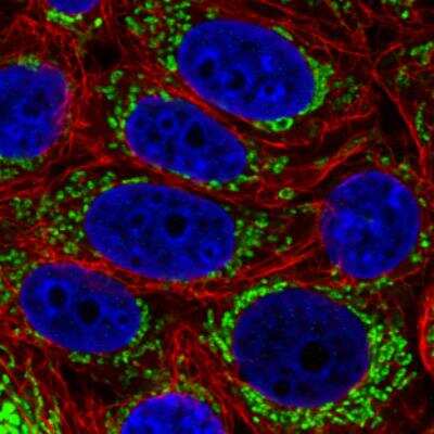 Immunocytochemistry/ Immunofluorescence: TUFM Antibody (CL2243) [NBP2-36752]