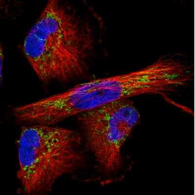 Immunocytochemistry/ Immunofluorescence: TUFM Antibody (CL2243) [NBP2-36752]