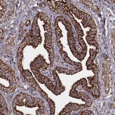 Immunohistochemistry-Paraffin: TUFM Antibody (CL2243) [NBP2-36752]