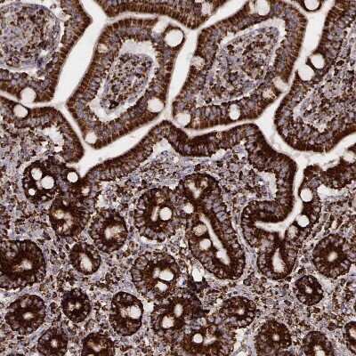 Immunohistochemistry-Paraffin: TUFM Antibody (CL2243) [NBP2-36752]