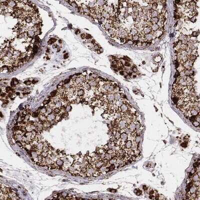 Immunohistochemistry-Paraffin: TUFM Antibody (CL2243) [NBP2-36752]